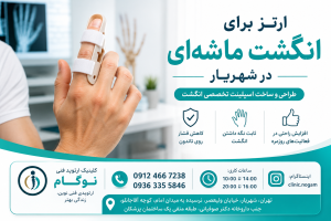 ارتز برای انگشت ماشه‌ای در شهریار | طراحی و ساخت اسپلینت تخصصی انگشت