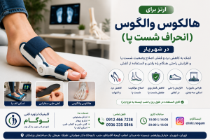 ارتز برای هالکوس والگوس (انحراف شست پا) در شهریار
